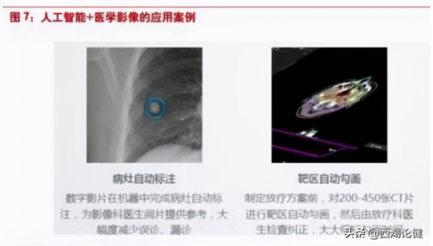 be365体育平台:医学影像智能识别：医疗与AI集合凯旋案例(图8)